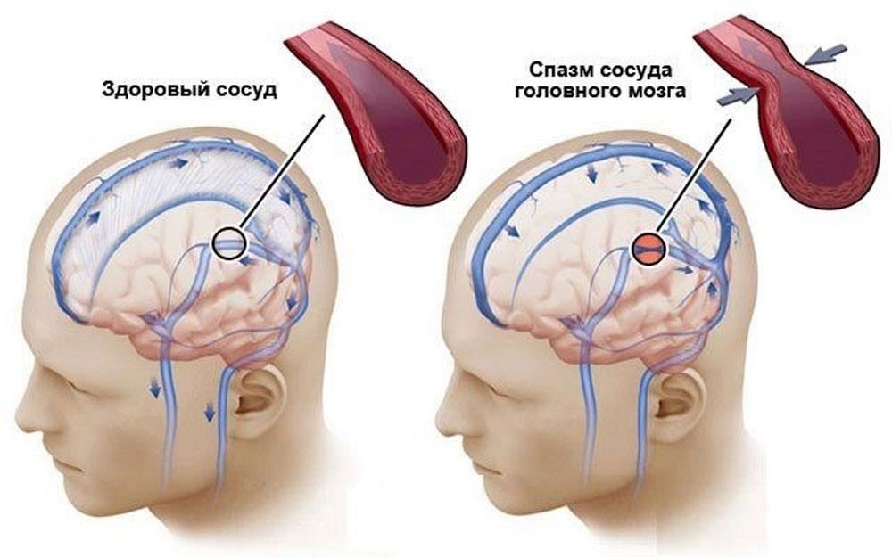 Если головокружение не проходит или усиливается, не стесняйтесь записаться на прием к ЛОР-специалисту, чтобы убедиться в своем здоровье и благополучии. Своевременное вмешательство может иметь решающее значение для успешного лечения.